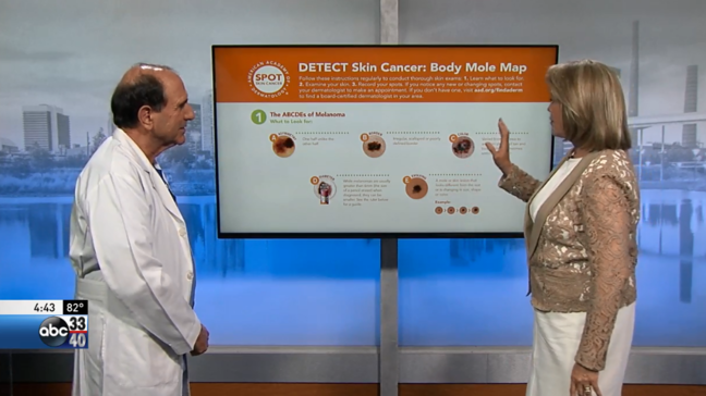Melanoma awareness: Detecting skin cancer