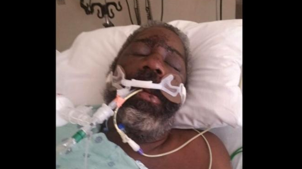 Hendersonville man in coma after beating with baseball bat, family says