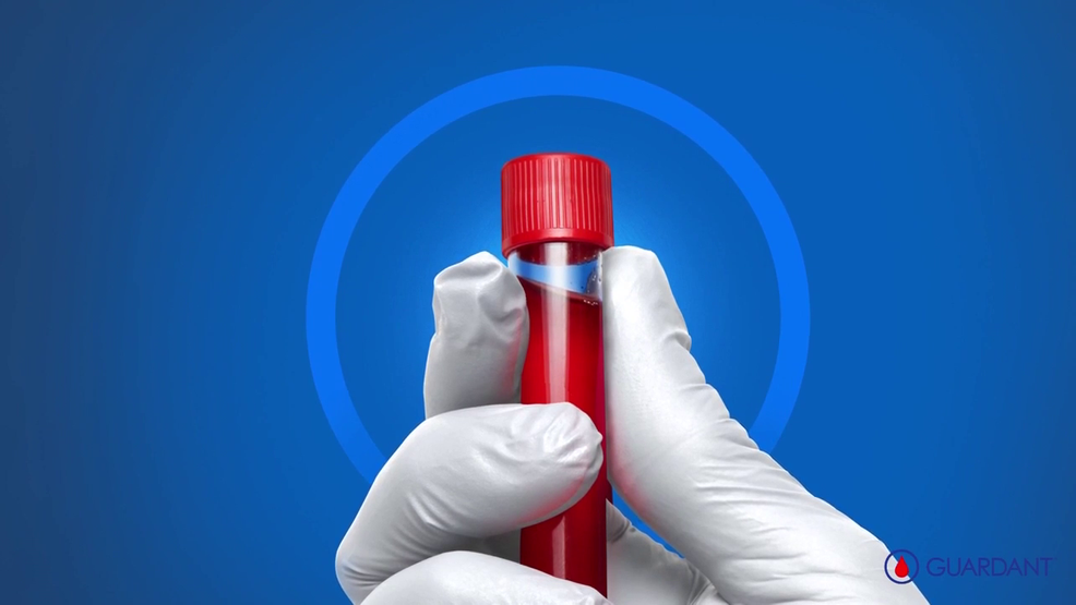 Promising New Blood Test Provides Hope For Lung Cancer Patients KEYE